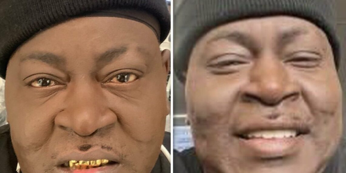 Trick Daddy Got New Teeth Procedure For His Reality TV Show, Old Teeth Were Rotten - Sis2Sis